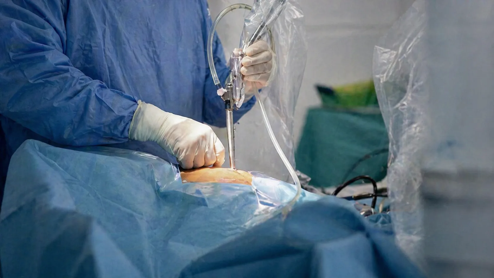 Хирургическая операция в стерильной обстановке