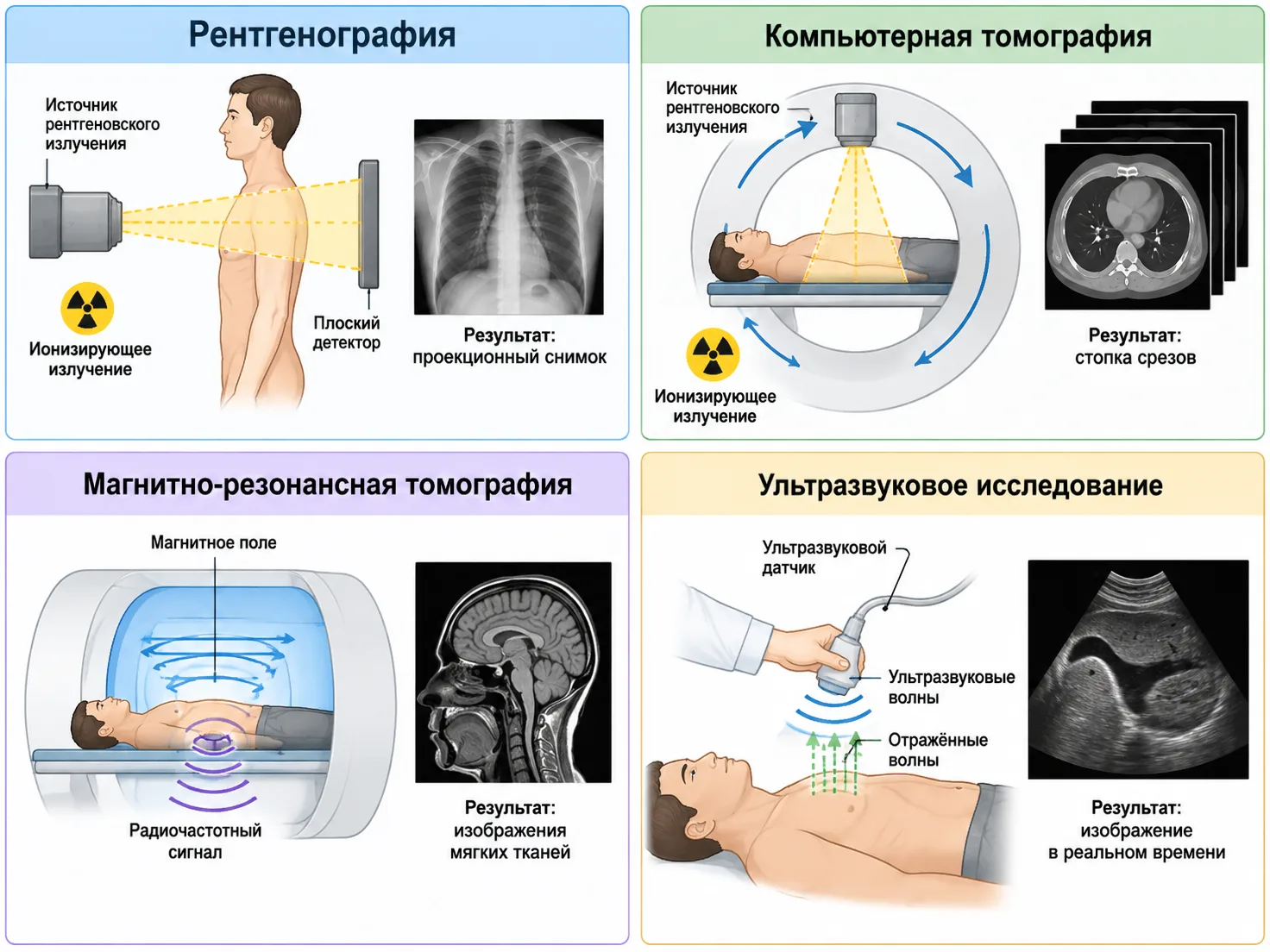 Как рентгенография, КТ, МРТ и УЗИ получают изображения