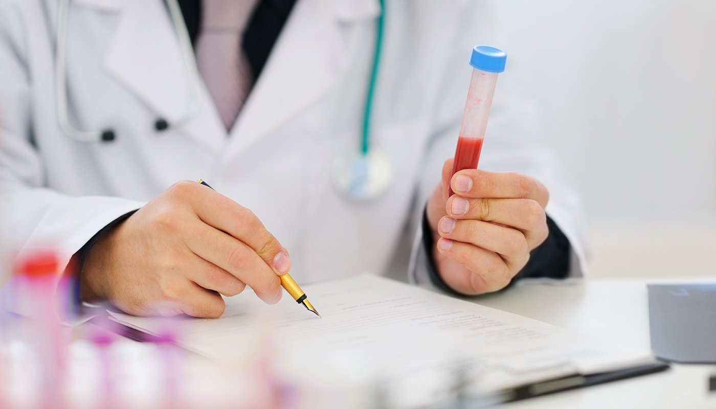 Положительный результат на гепатит C: может быть, это ошибка?