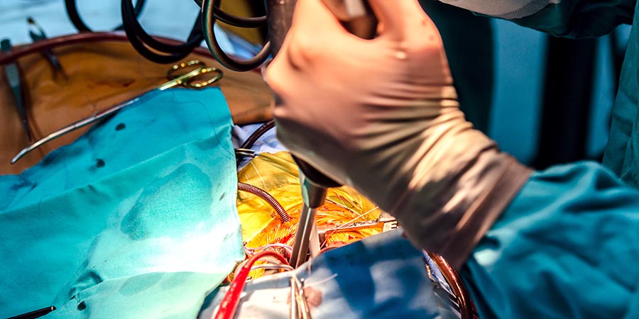 Импланты из искусственной сердечной мышцы помогли улучшить состояние после инфаркта