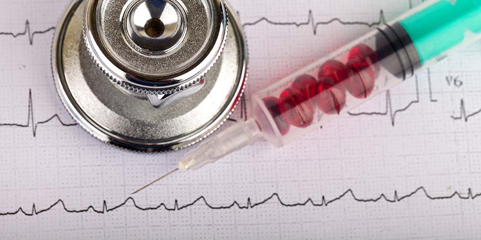 Генная терапия помогает прекратить фибрилляцию предсердий