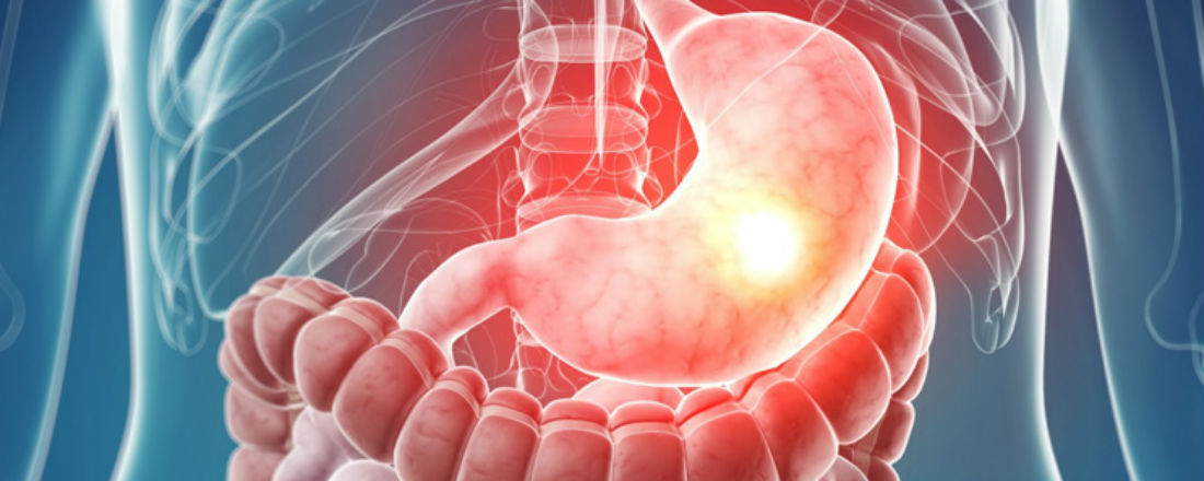 Лечение рака желудка