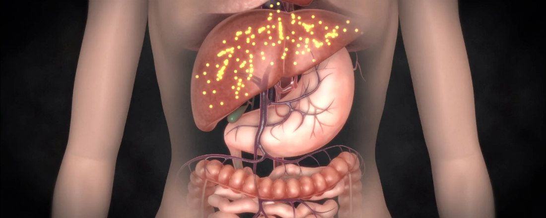 Рак печени лечение