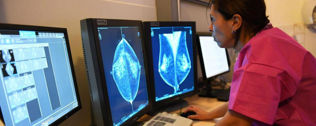 Стадии рака молочной железы