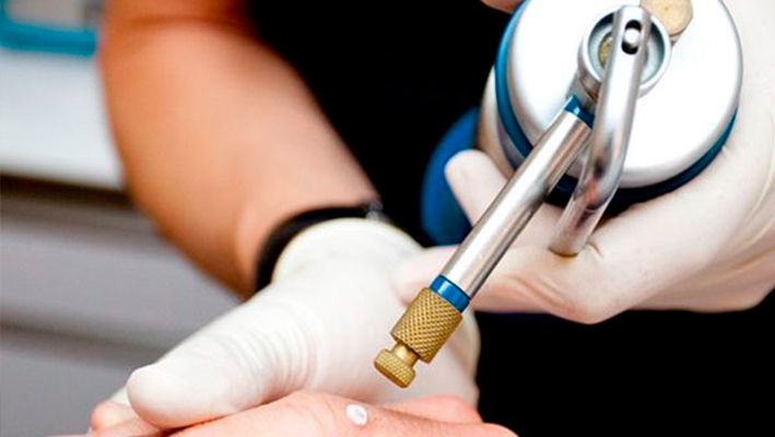 borodavka-na-podoshve