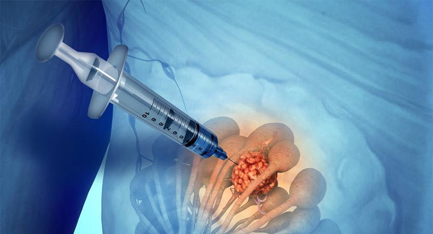 Аспирационная биопсия в международной клинике Медика24