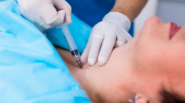 biopsiya-shhitovidki1