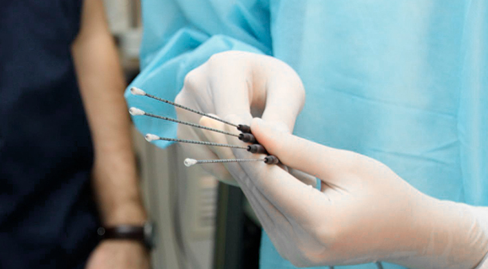 Биопсия гортани