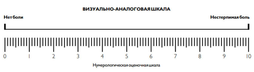 Болевой синдром