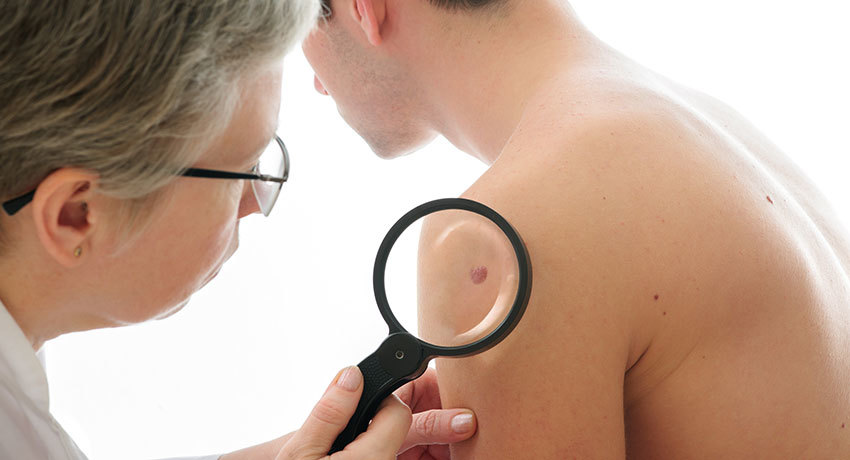 Диагностика рака кожи