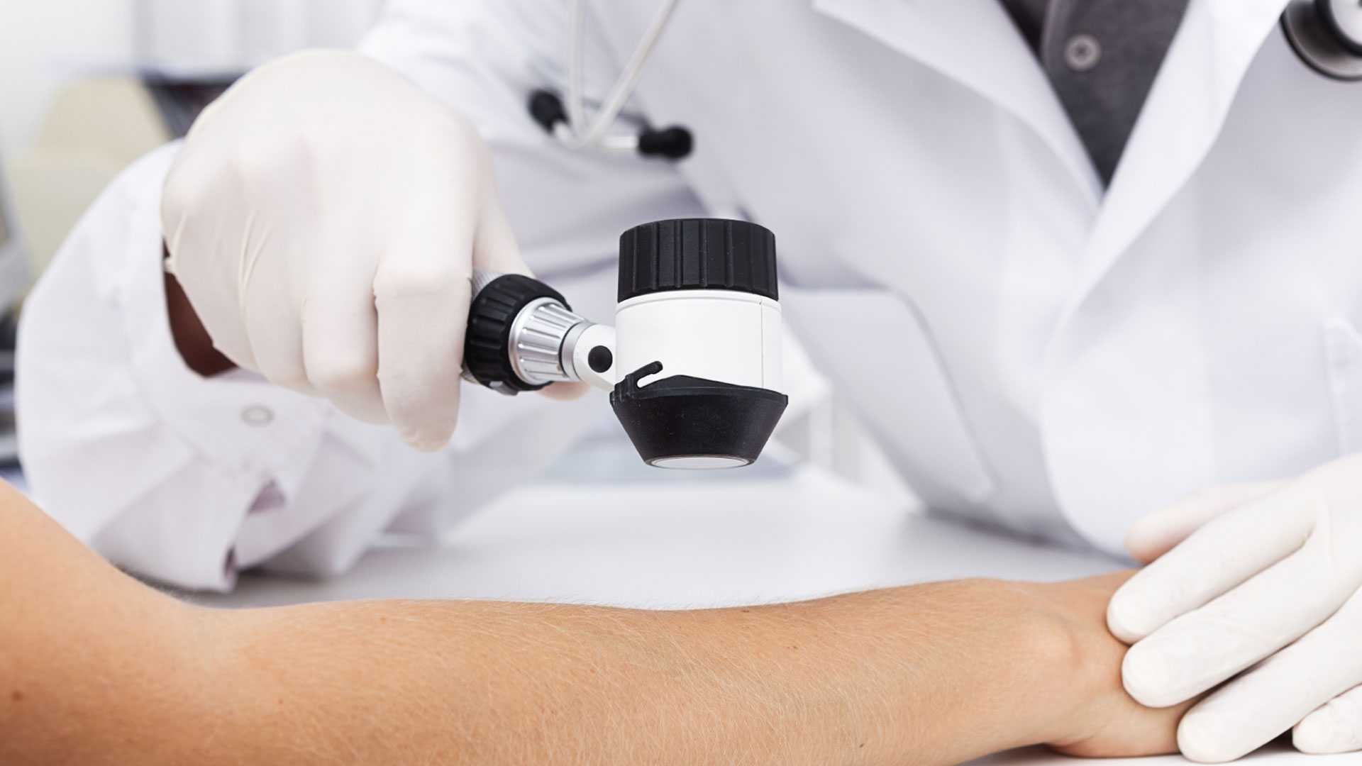 Как определить рак кожи?