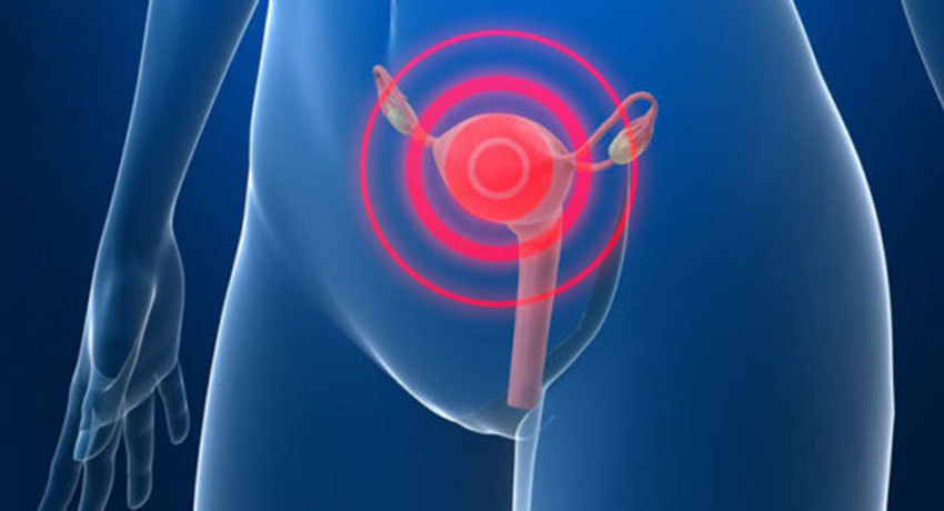 Симптомы рака матки