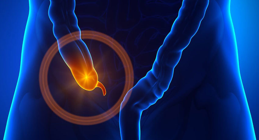 Лечение рака слепой кишки