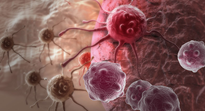 cancer-zjeludok-09012019-0