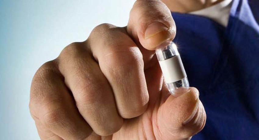 Капсульная эндоскопия