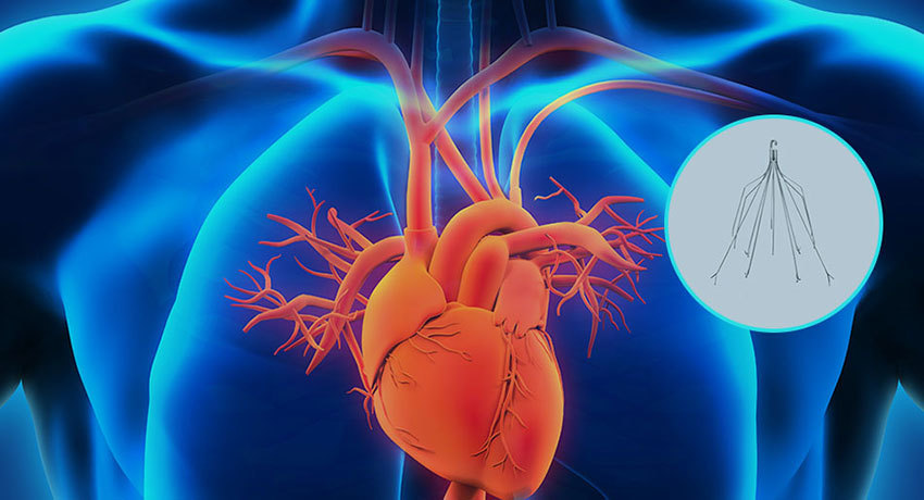 Кава-фильтр