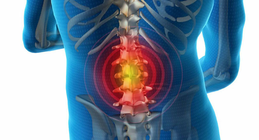 Дорсопатия поясничного отдела позвоночника