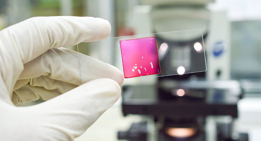 Показания к эндоскопической подслизистой диссекции