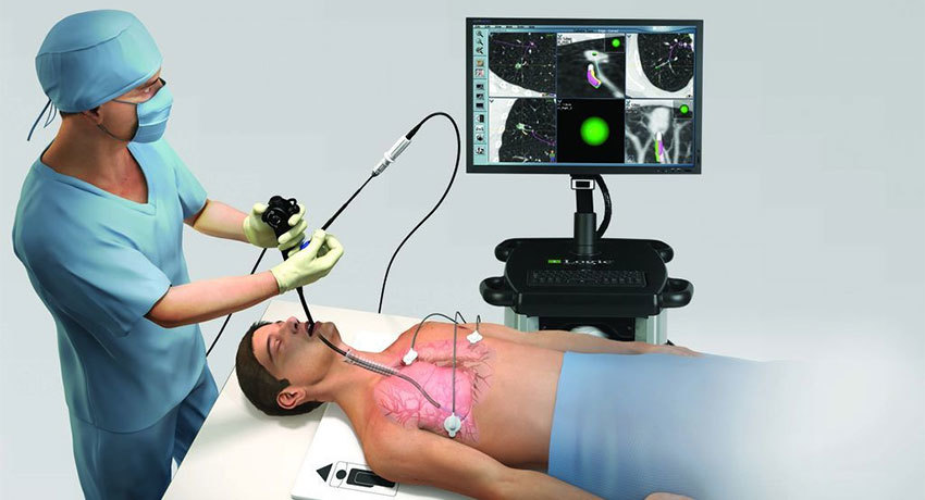 Эндоскопическое исследование трахеи и бронхов