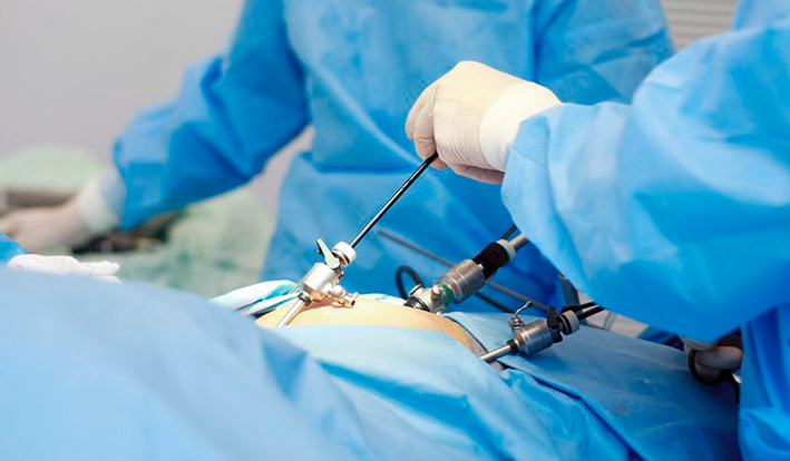 endometrioz-lechenie