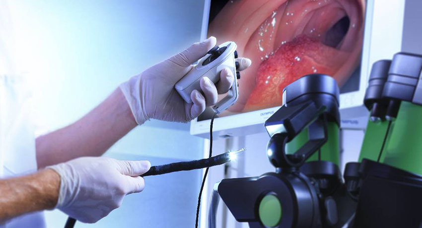 Эндоскопическая ультрасонография