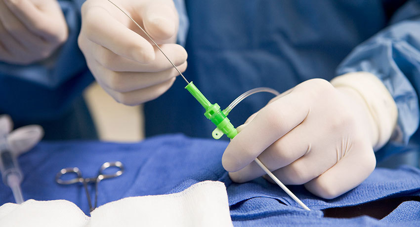 Эндоваскулярная операция