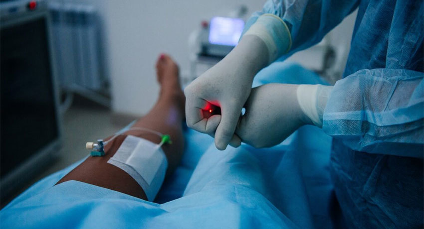 Эндовазальная лазерная коагуляция вен в международной клинике Медика24