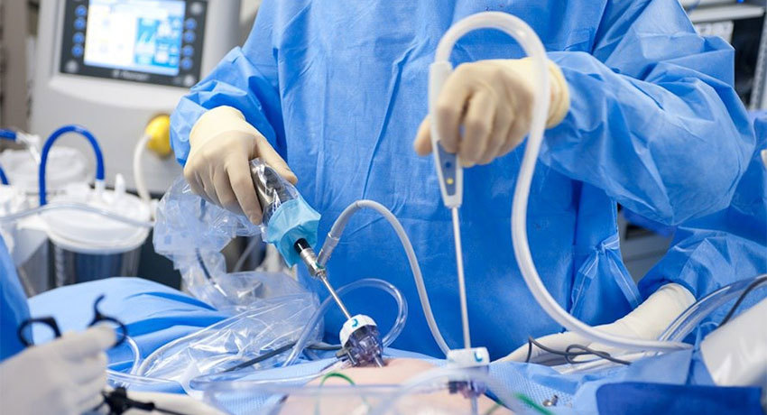 Современные методы хирургического лечения при гастроинтестинальных стромальных опухолях