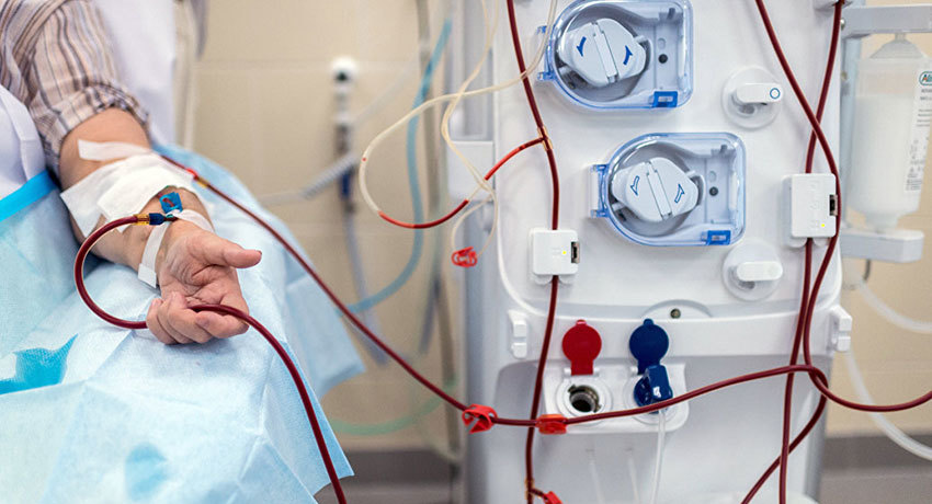 Гемодиализ