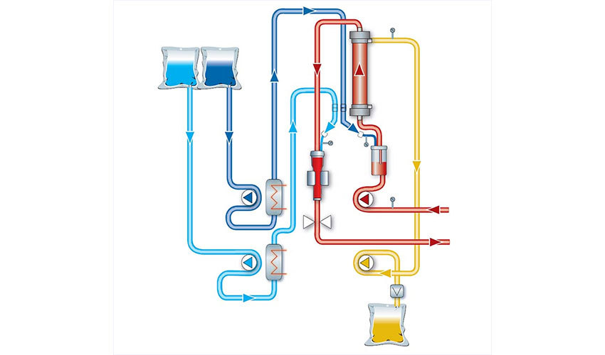 Гемофильтрация