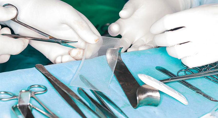 Герниопластика