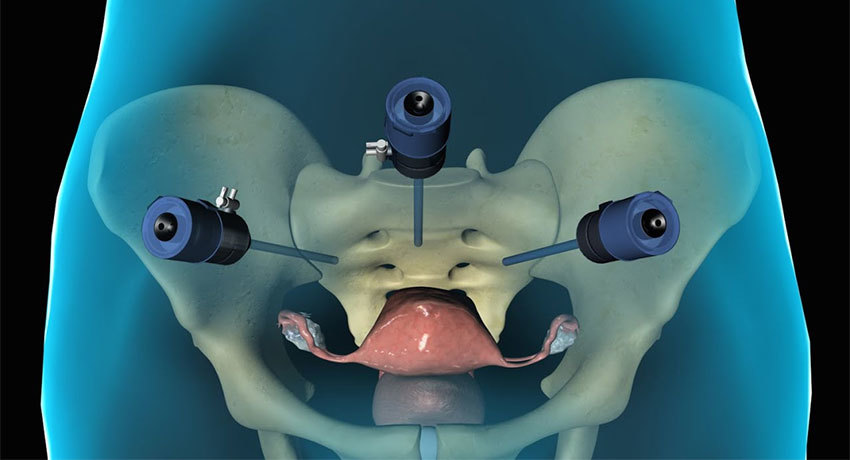 Проведение гистерэктомии в международной клинике Медика24