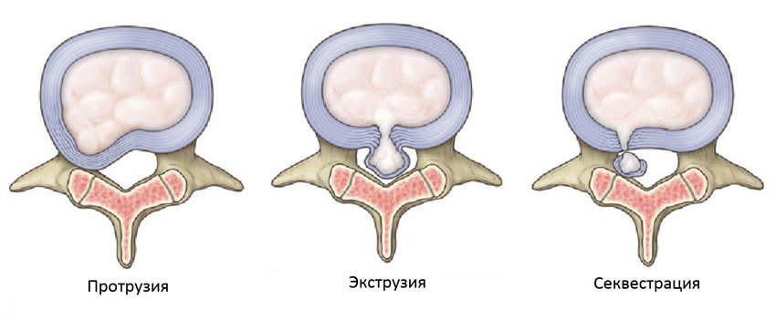 griga-poyasnitsa-04122019-2
