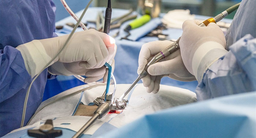 Операция на позвоночнике