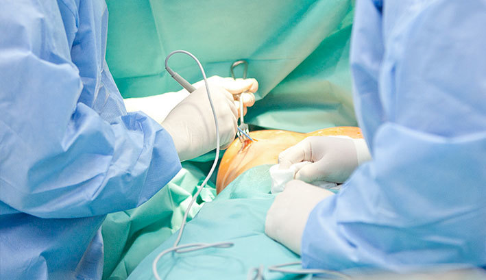 Операция при раке груди: фото