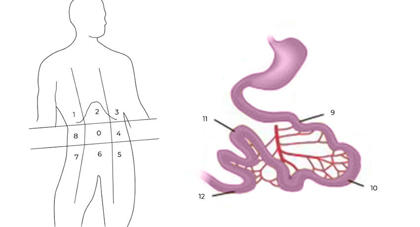 Разделение брюшной полости на участки для определения PCI