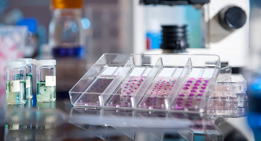 Иммуногистохимическое исследование