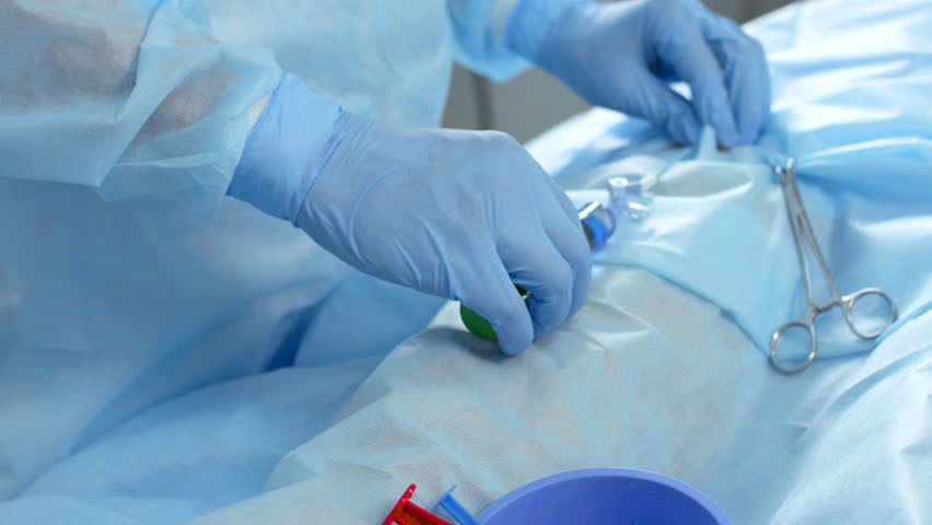 Химиоэмболизация