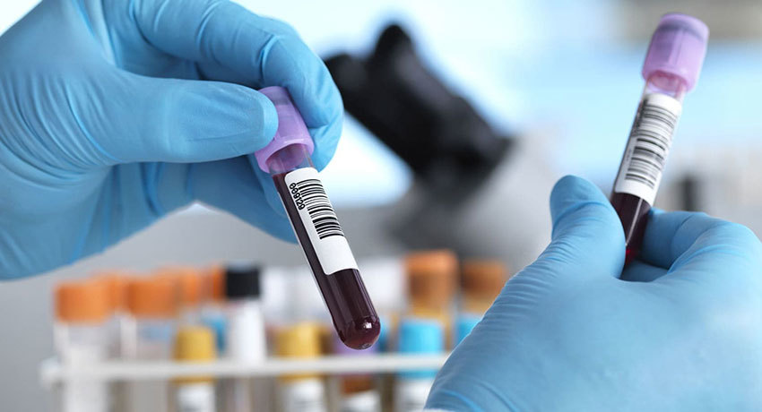 Диагностика лейкоза