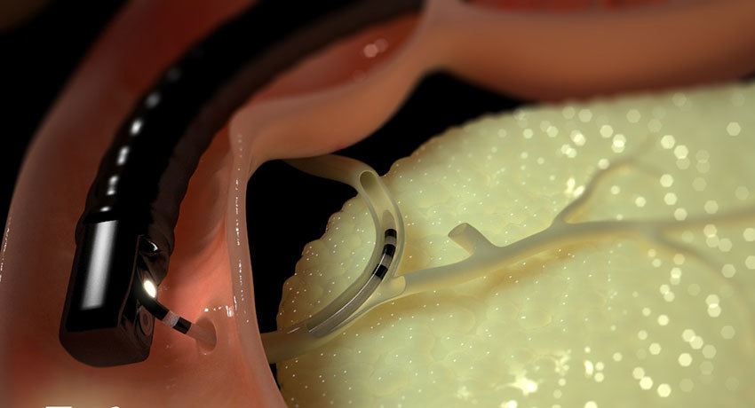 Проведение РХПГ