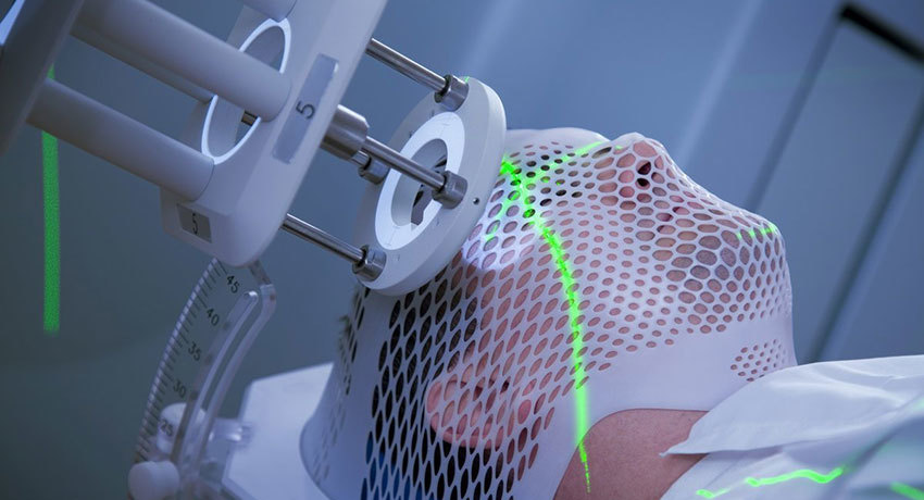 Проведение лучевой терапии