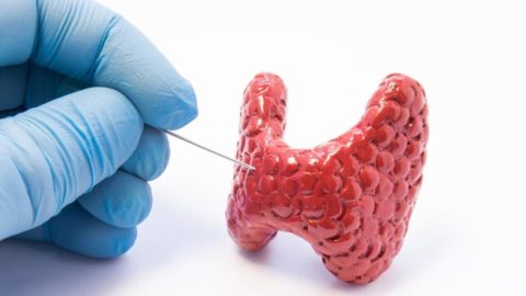 Пункционная биопсия щитовидной железы