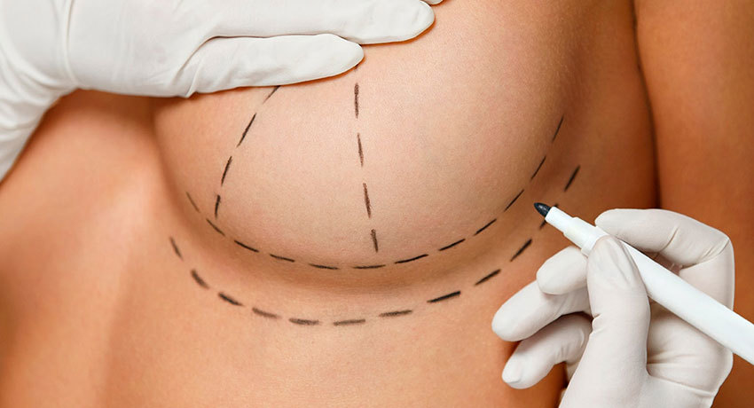 Маммопластика в международной клинике Медика24