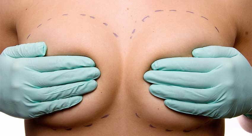 Мастэктомия с реконструкцией груди