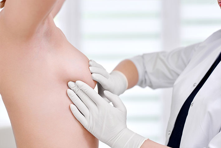 mastopatiya-diffuznaya