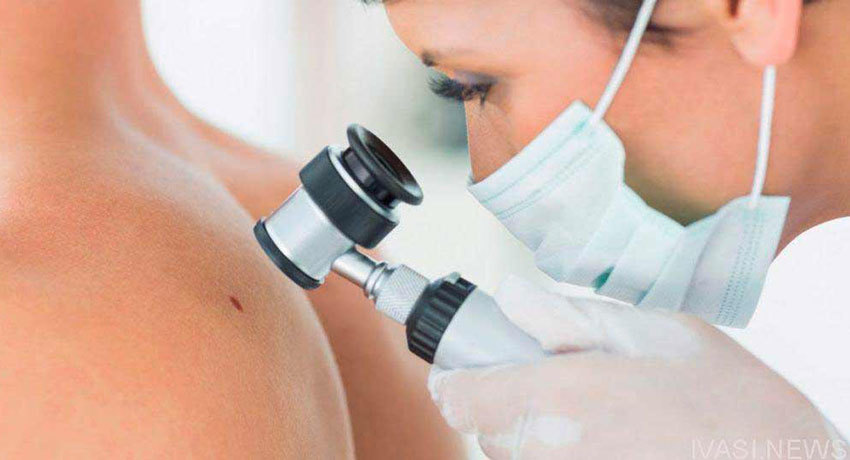 Лечение меланомы