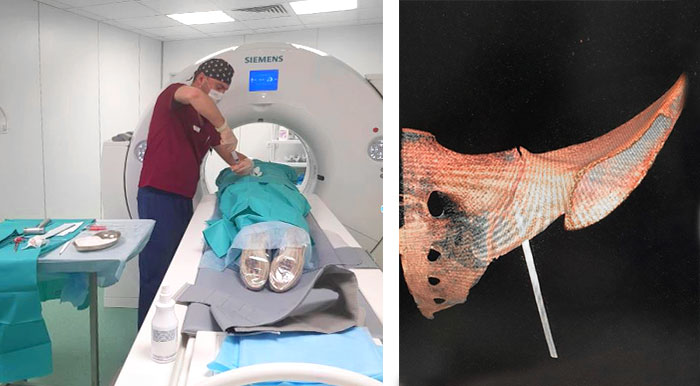 metastazy-v-kostyah4