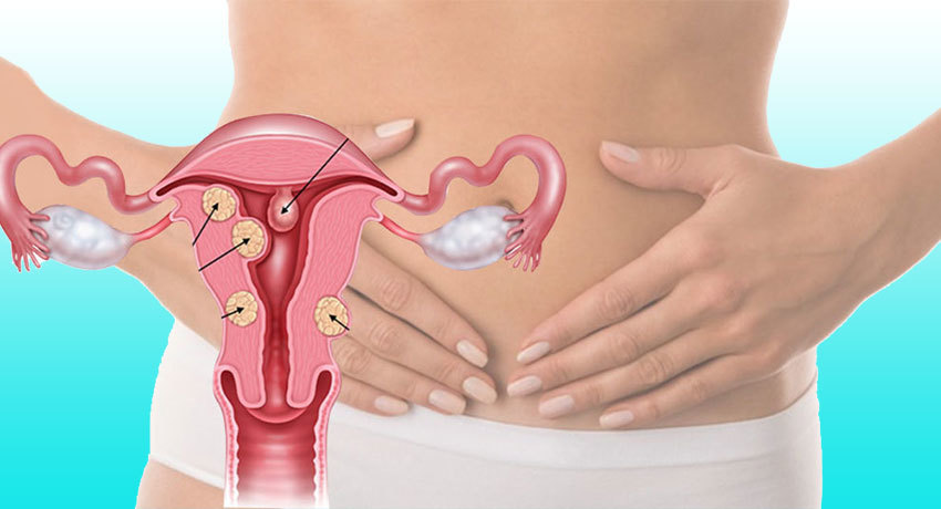 Лечение метастазов в мочевом пузыре