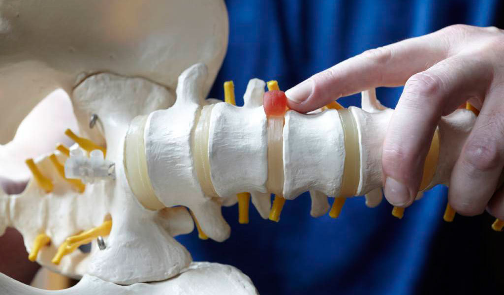 Сколько стоит лечение грыжи позвоночника в Москве?