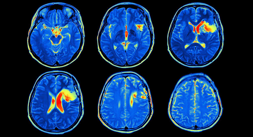 МРТ с контрастом